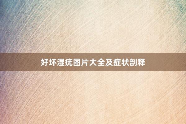 好坏湿疣图片大全及症状剖释